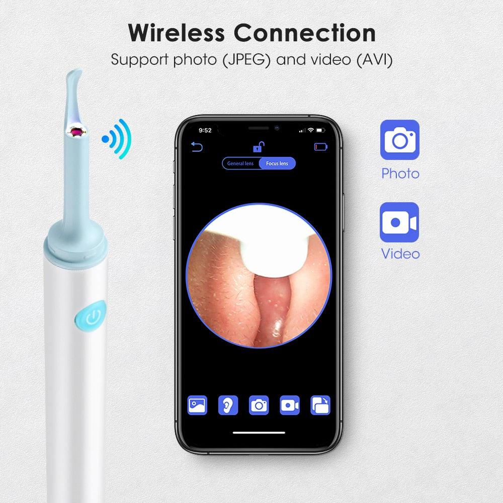Visual Ear Cleaner Pro