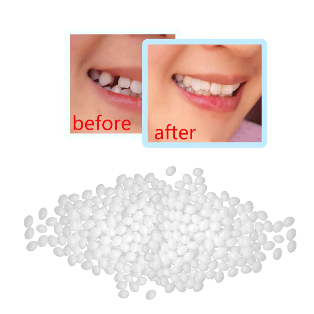 3x DIY Tooth Repair Kit (BUY 1 GET 1 FREE)